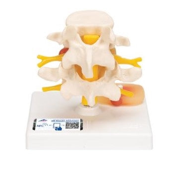 Human Lumbar Spinal Column